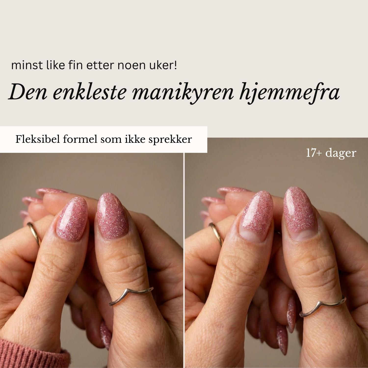 ONE STEP GEL STARTSETT | UTSOLGT